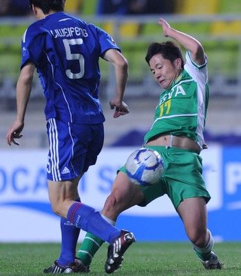 các kiểu mắt